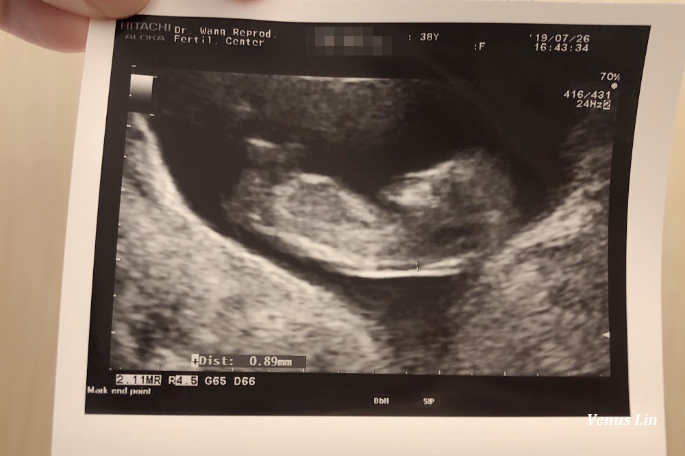 懷孕 關於寶寶的性別 是小小v還是小小郭 第幾週知道是男寶寶還女寶寶 購物狂女王venus